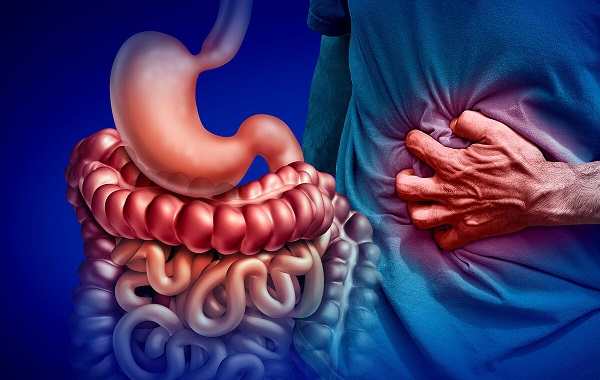 Bệnh Crohn là gì? | PK Bệnh viện Đại học Y Dược 1